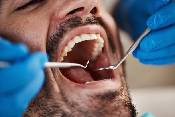 Best Weekend Emergency Dentist in Santaquin, UT